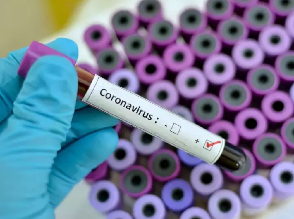 कोरोनावायरस को लेकर लोगों ने पाल रखा है ये खतरनाक भ्रम, हो सकता है बेहद जानलेवा