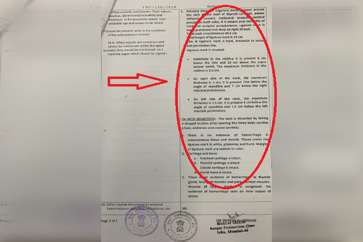 सुशांत के गले की हड्डी नहीं टूटी थी, पोस्टमार्टम रिपोर्ट में हुआ अब ये बड़ा खुलासा