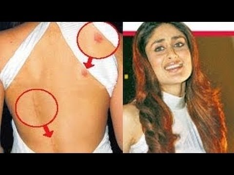 खुद को वर्जिन बताने वाले सलमान से कटरीना कैफ तक जब लव बाईट छिपाना भूल गये ये बॉलीवुड स्टार