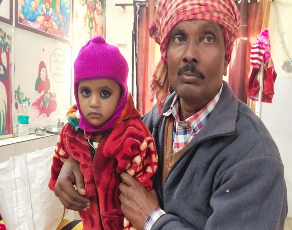 भयंकर कुपोषण का शिकार है यूपी का यह जिला, बेटो और बेटियों में होता है भेदभाव