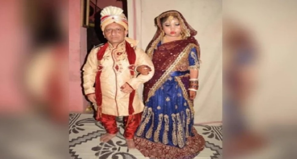 अनोखी शादी: 5.5 फीट की दुल्हन, 3 फीट का दुल्हा, इस वजह से हुई ये शादी