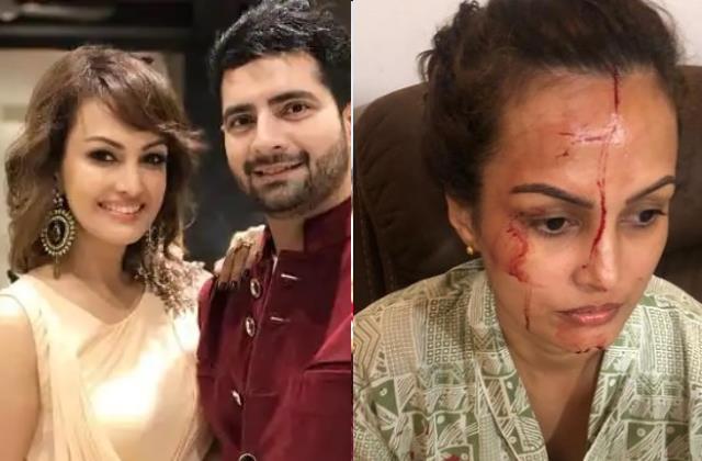 निशा रावल ने दिखाया चोट कहा, 'मारा-पीटा फिर फोड़ा मेरा सिर' पति करण ने कहा, 'खुद को मारकर मुझे....