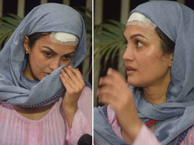 निशा रावल ने दिखाया चोट कहा, 'मारा-पीटा फिर फोड़ा मेरा सिर' पति करण ने कहा, 'खुद को मारकर मुझे....