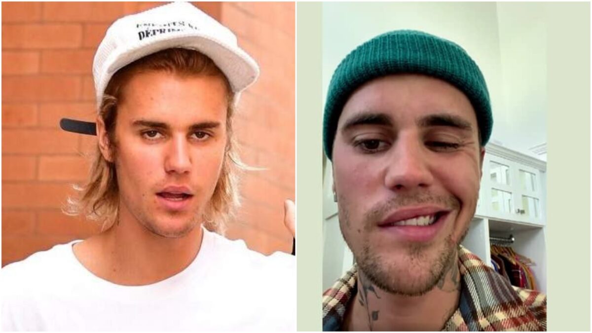 पॉप सिंगर Justin Bieber का आधा चेहरा हो गया हैं इस बीमारी से ग्रसित, मुंह से बोल पाना भी हुआ मुश्किल