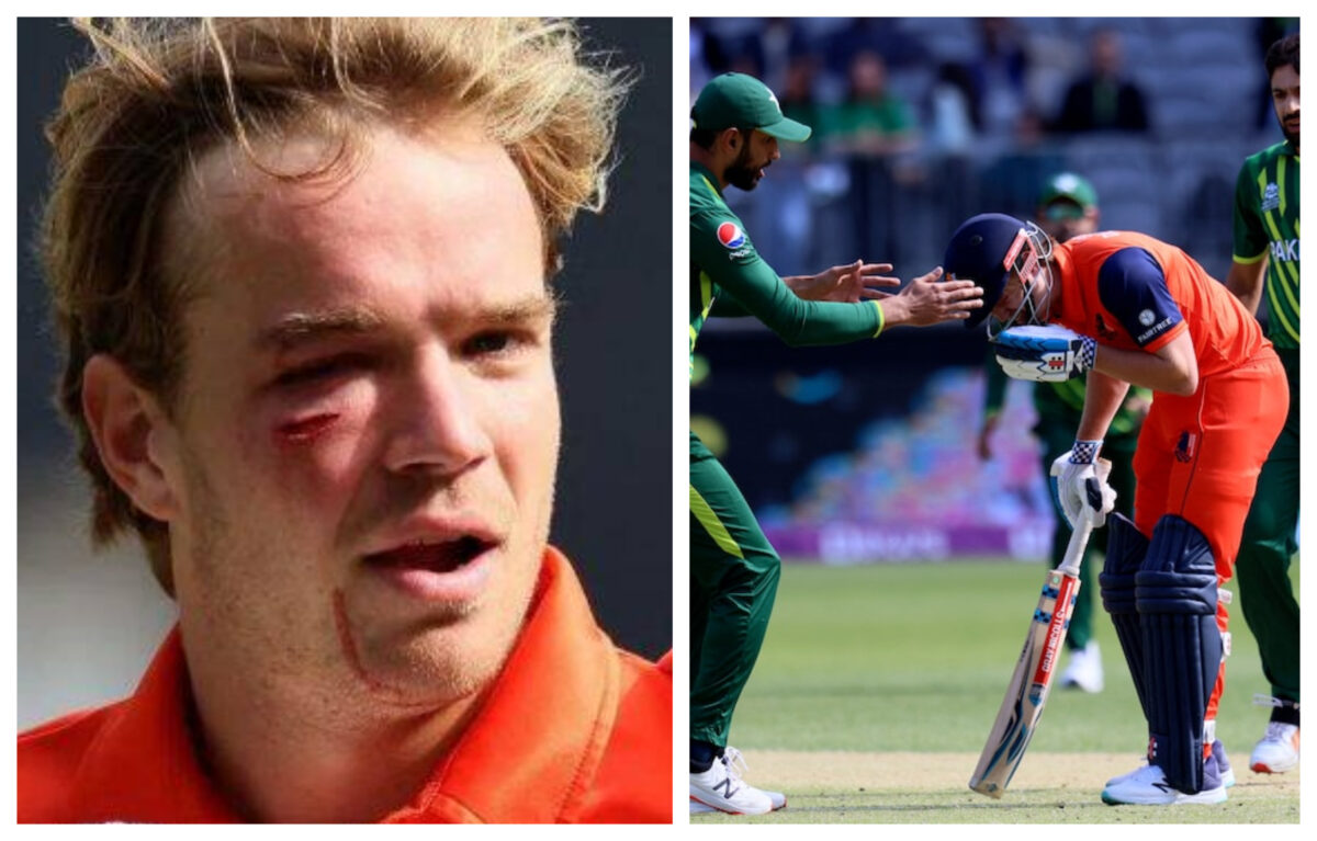 Haris Rauf की घातक गेंद पर घायल हुआ नीदरलैंड्स बल्लेबाज़, मैदान में बहा खून