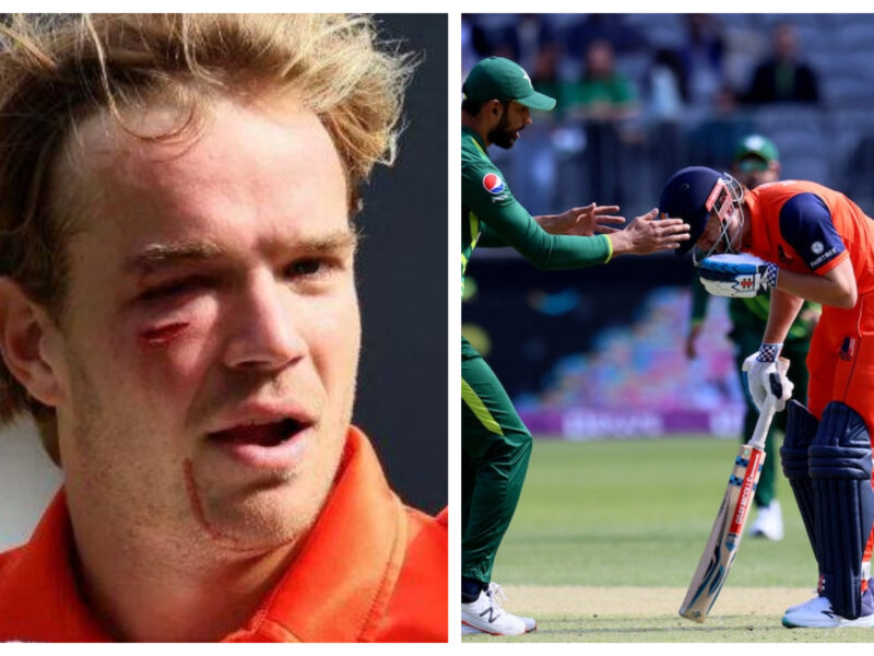 Haris Rauf की घातक गेंद पर घायल हुआ नीदरलैंड्स बल्लेबाज़, मैदान में बहा खून