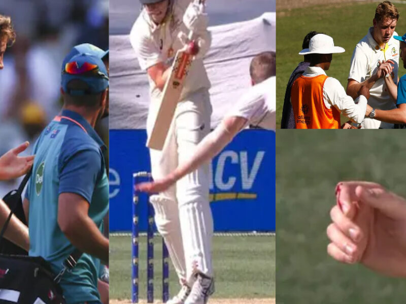 Video: Ipl में 17.5 करोड़ में बिकने वाले Cameron Green हुए बुरी तरह चोटिल, बीच मैच में उंगली से पानी की तरह बहा खून, वायरल हुआ वीडियो