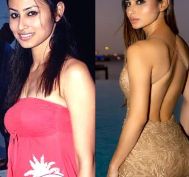 Moni Roy Plastic Surgery