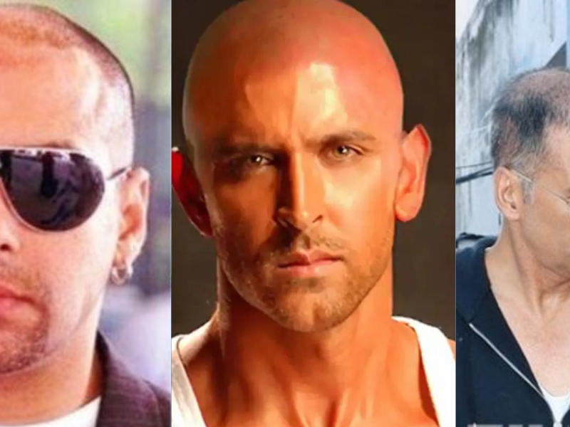 These-6-Famous-Bollywood-Stars-Have-Gone-Bald-In-Real-Life