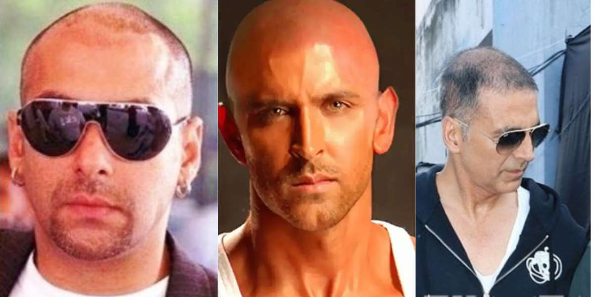 These-6-Famous-Bollywood-Stars-Have-Gone-Bald-In-Real-Life