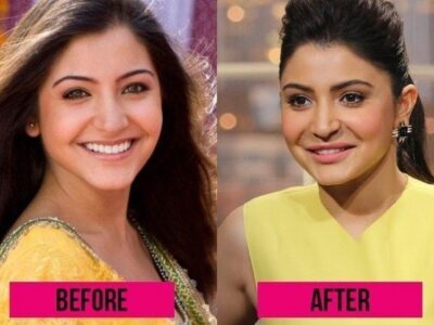 5-Bollywood-Actresses-Who-Did-Plastic-Surgery