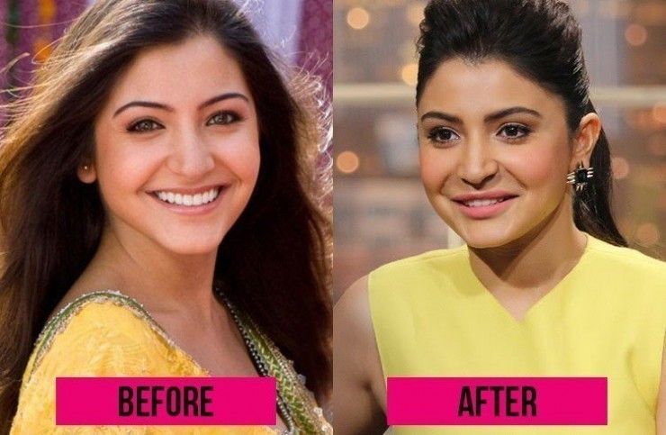 5-Bollywood-Actresses-Who-Did-Plastic-Surgery