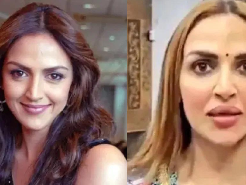 After-Divorcing-Her-Husband-Esha-Deol-Got-Lip-Surgery-Done-People-Trolled-Her-Asked-What-Went-Wrong