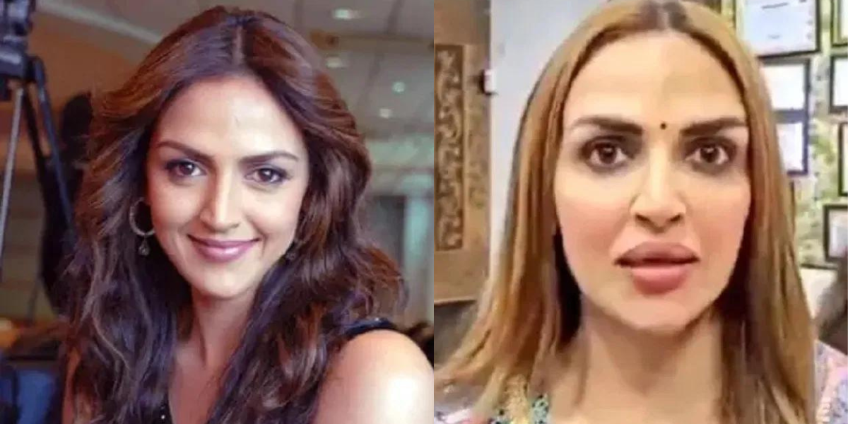 After-Divorcing-Her-Husband-Esha-Deol-Got-Lip-Surgery-Done-People-Trolled-Her-Asked-What-Went-Wrong