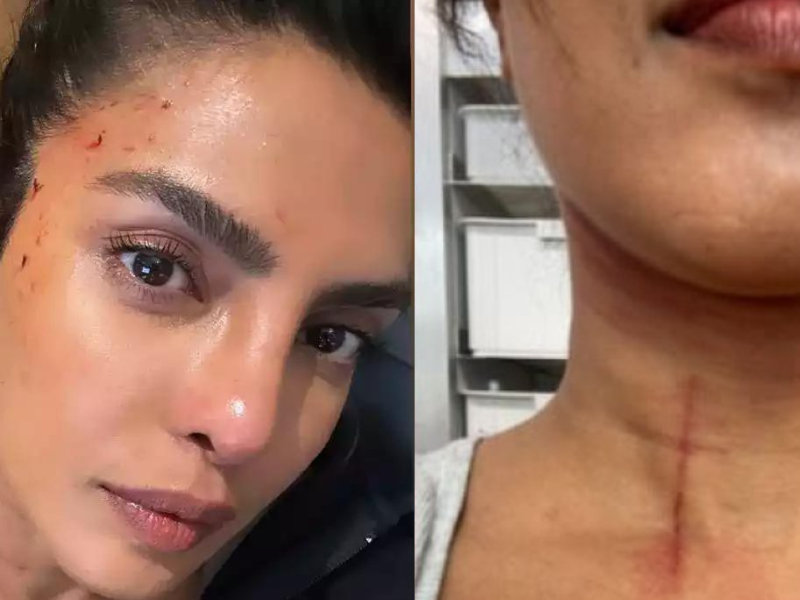 Priyanka-Chopra-Seen-Drenched-In-Blood-Suffered-Serious-Injury-While-Shooting-Stunt-Scene-Video-Surfaced