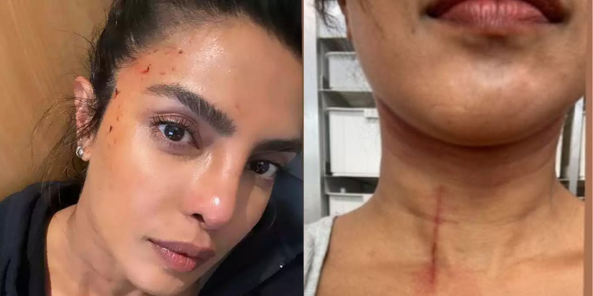 Priyanka-Chopra-Seen-Drenched-In-Blood-Suffered-Serious-Injury-While-Shooting-Stunt-Scene-Video-Surfaced