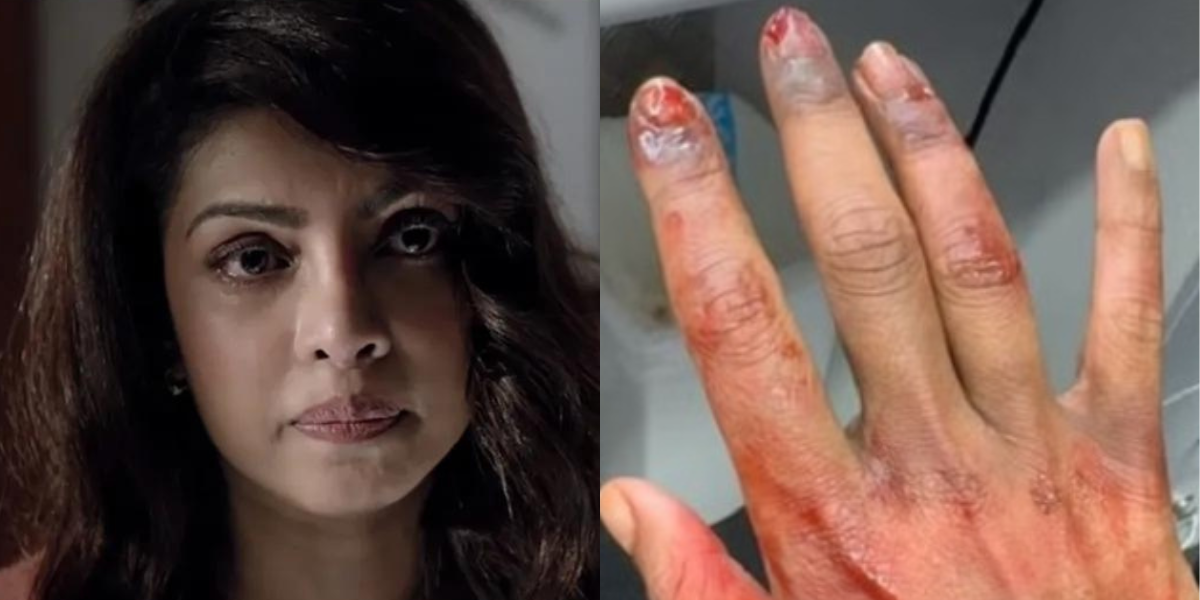 Priyanka-Chopra-Got-Badly-Injured-Face-Soaked-In-Blood-Swollen-Fingers-Fans-Got-Scared-After-Seeing-Such-Condition-Of-The-Actress