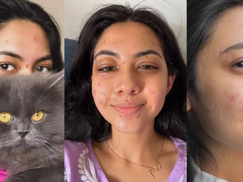 Reem-Shaikh-This-Famous-Actress-Was-Not-Fit-To-Show-Her-Face-To-Anyone-Boiling-Oil-Fell-On-Her-Face-This-Is-What-Happened
