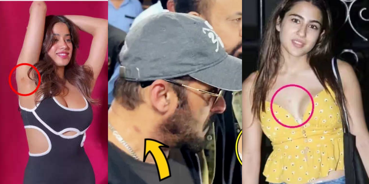 These Single Bollywood Stars Are Embarrassed By Showing Love Bites Every Day