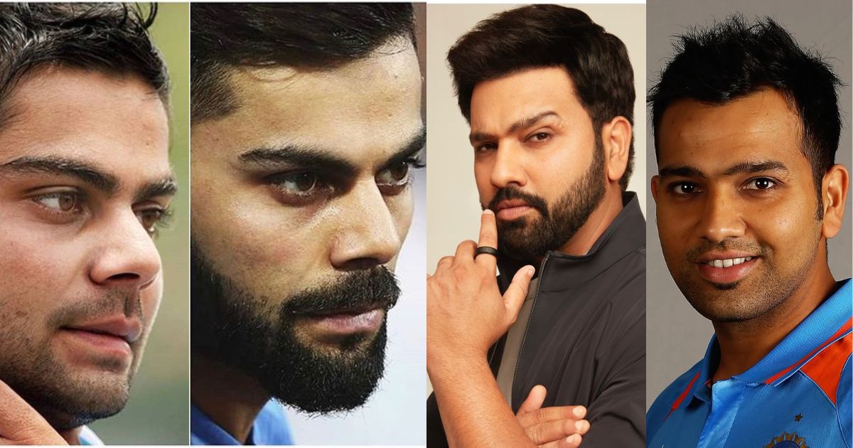 This Indian Player Got Facial Plastic Surgery Done