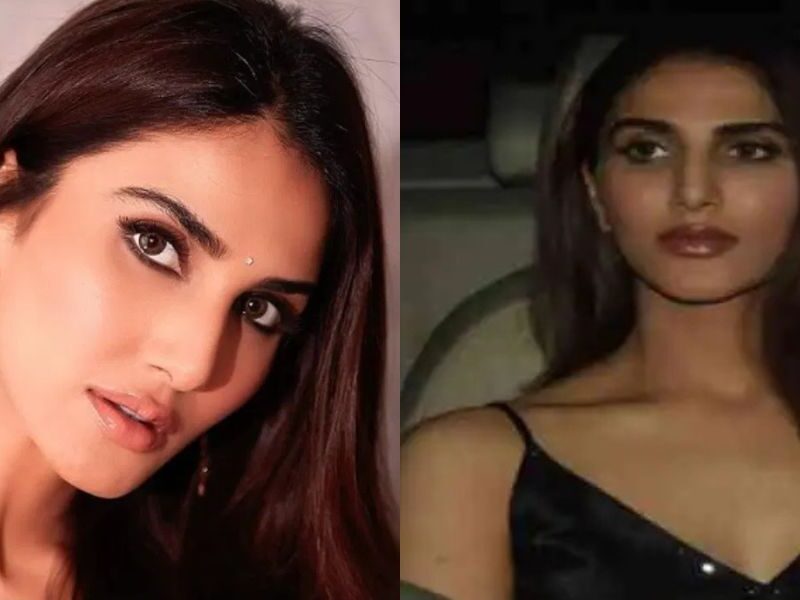 Vaani-Kapoor-Meets-With-A-Major-Accident