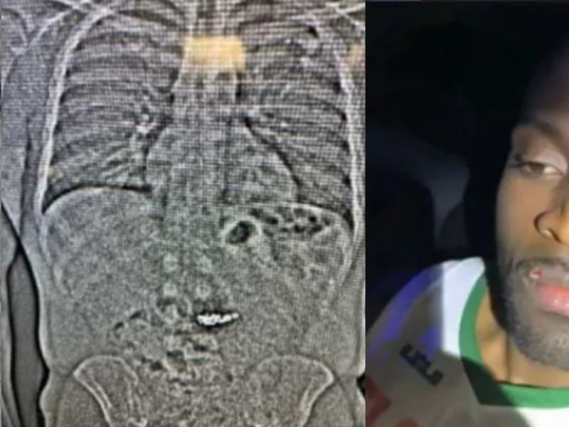 Viral-News-Where-Thief-Swallowed-Gold-Worth-Cr