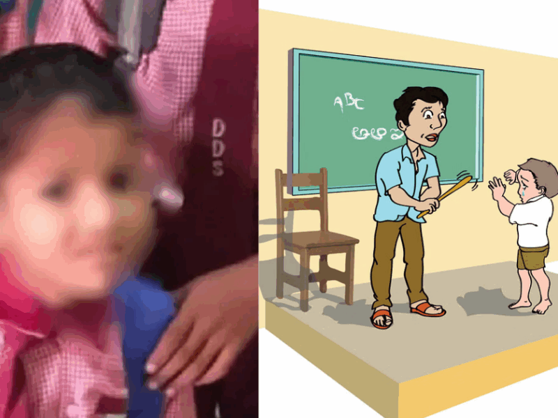 A 4-Year-Old Child Died After Being Slapped By His Teacher
