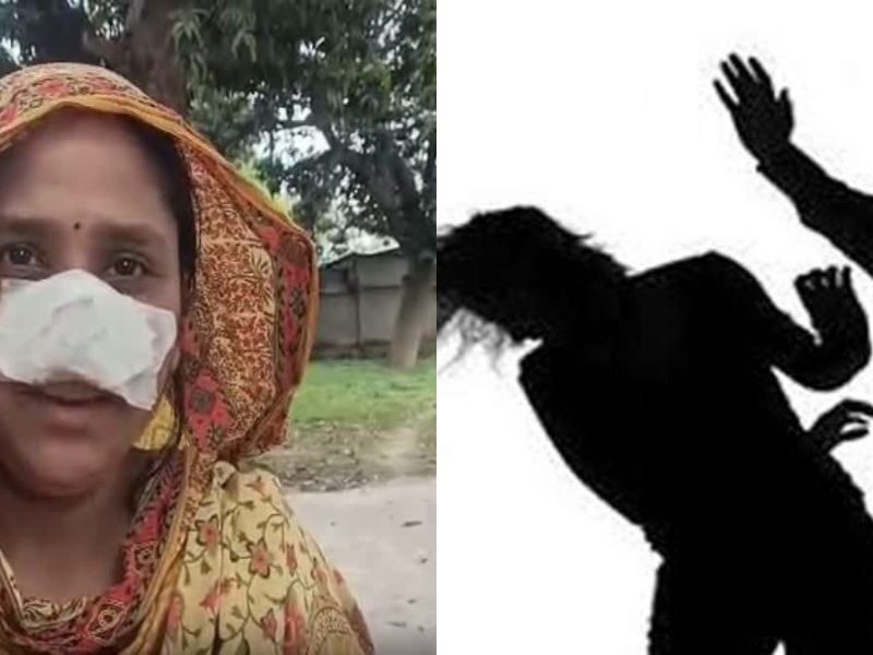 Cruelty-Of-Husband-Where-He-Ate-Wifes-Nose
