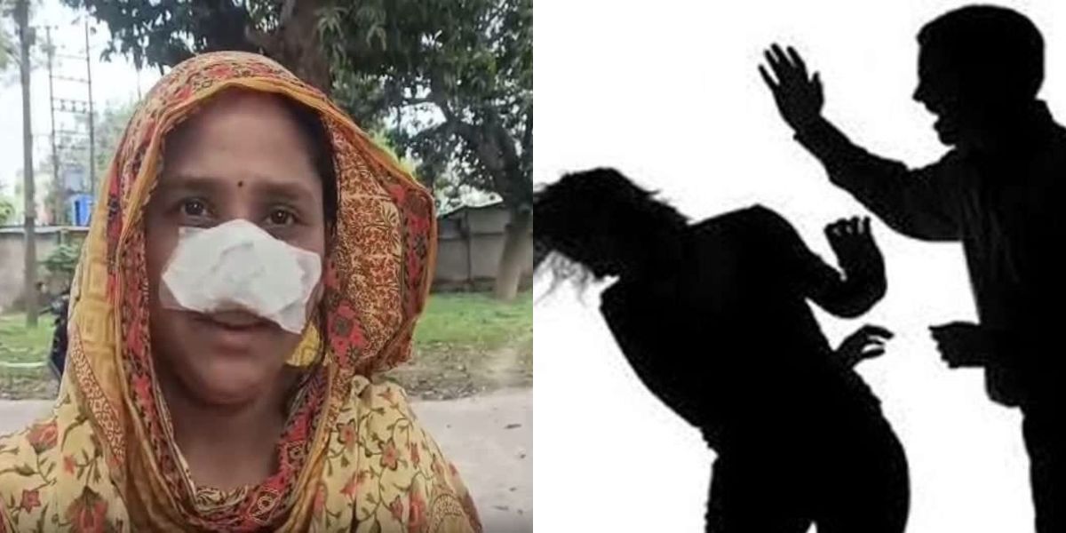 Cruelty-Of-Husband-Where-He-Ate-Wifes-Nose