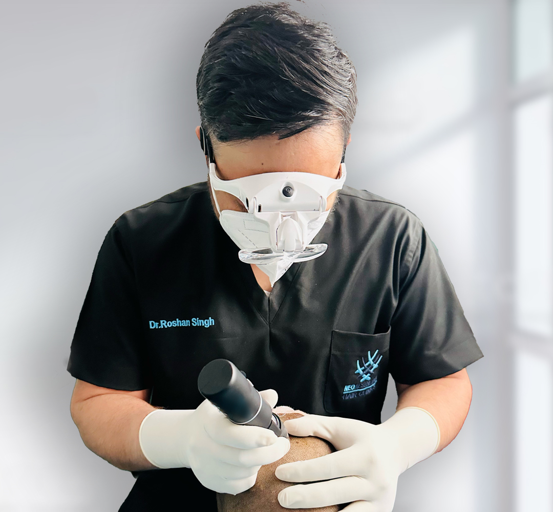 Hair Transplant