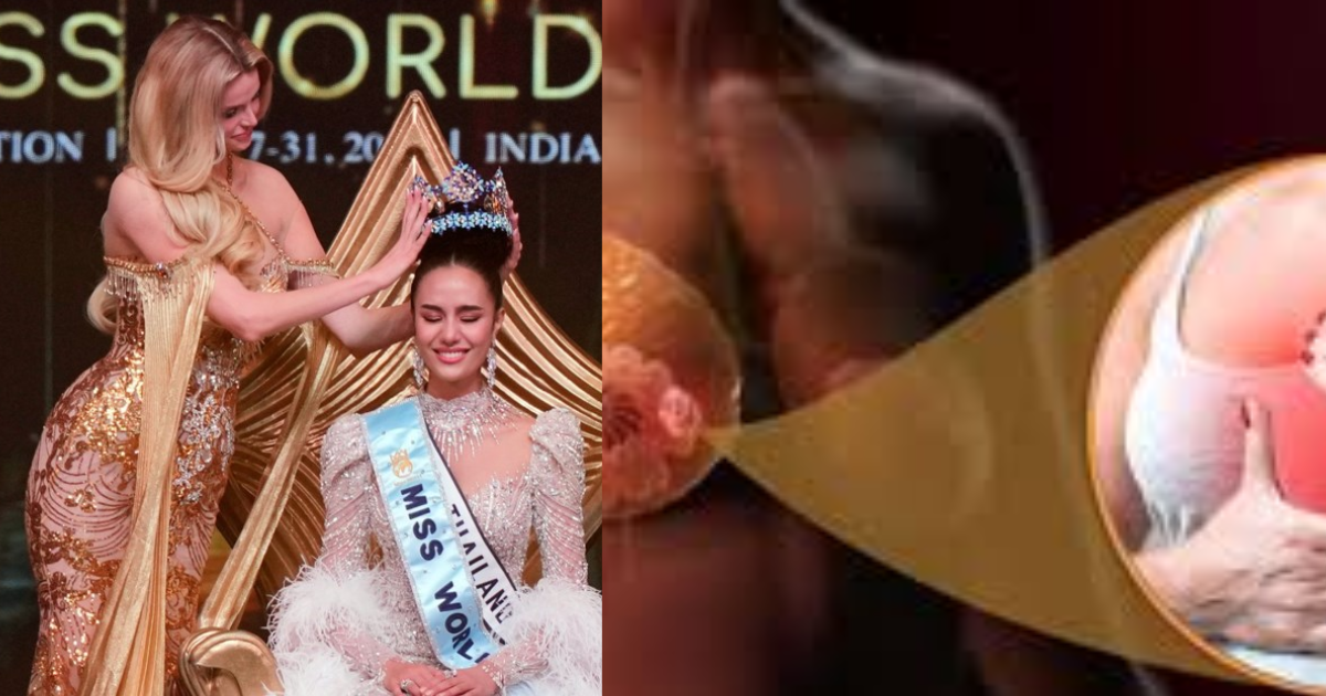 The-One-Whom-Doctors-Said-Needed-Surgery-Became-Miss-World-2025-Her-Story-From-Breast-Tumor-To-Crown