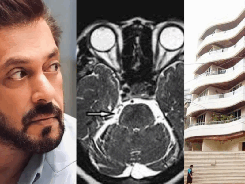 Salman-Khan-Is-Suffering-From-A-Serious-Illness-He-Divided-His-Property-Worth-2900-Crores-Out-Of-Fear-Of-Death