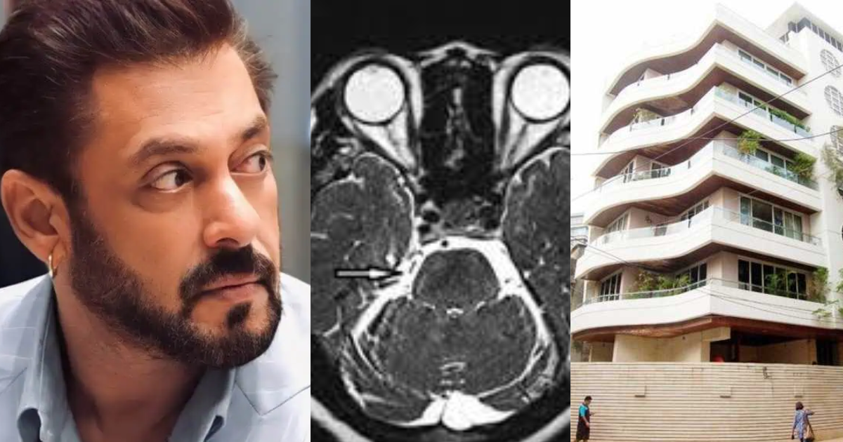 Salman-Khan-Is-Suffering-From-A-Serious-Illness-He-Divided-His-Property-Worth-2900-Crores-Out-Of-Fear-Of-Death