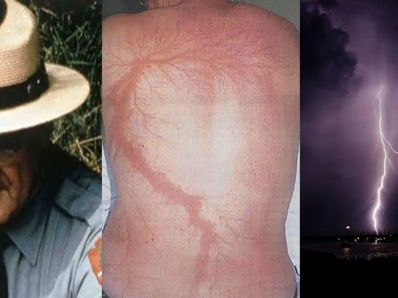 This Person Saved Himself From Lightning Strike 7 Times, Got The Name Living Thunder Magnet