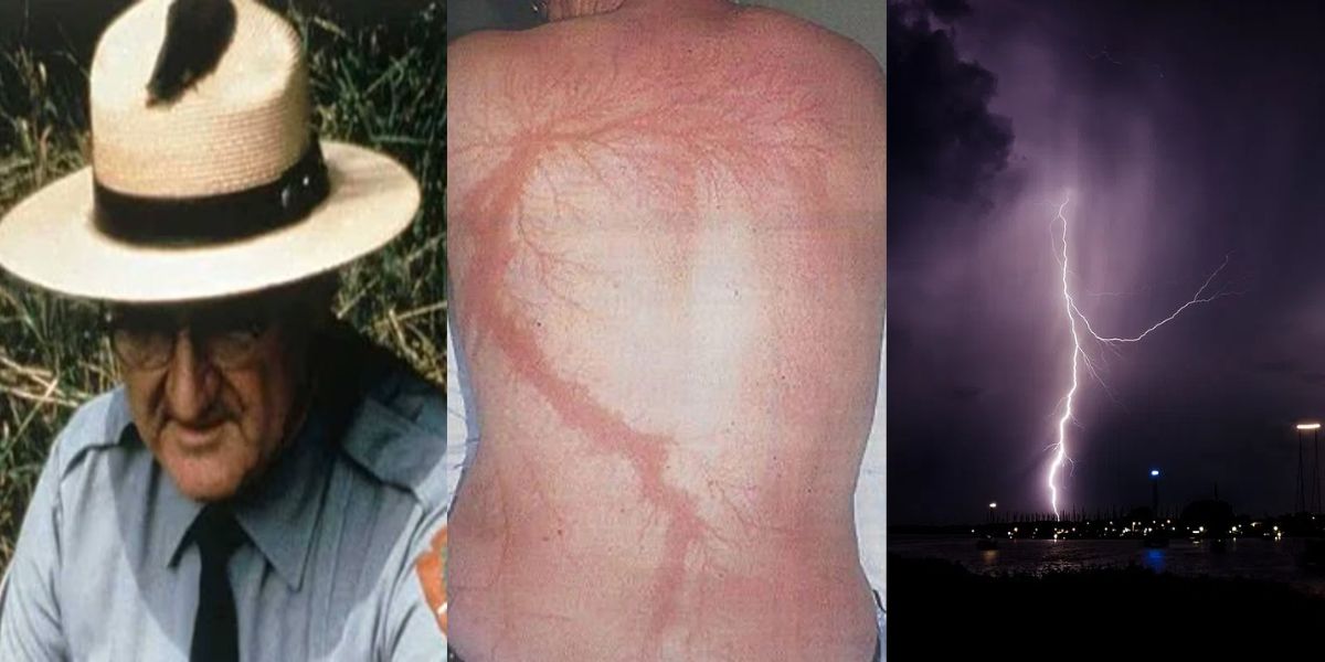 This Person Saved Himself From Lightning Strike 7 Times, Got The Name Living Thunder Magnet