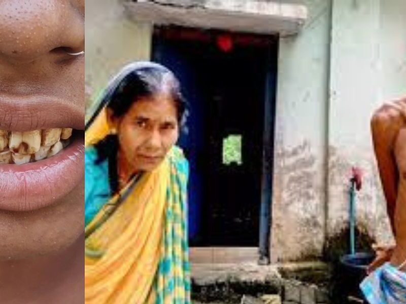 Viral-Diseases-Spread-In-Chhattisgarh-News