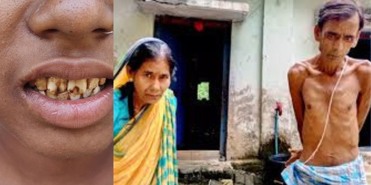 Viral-Diseases-Spread-In-Chhattisgarh-News