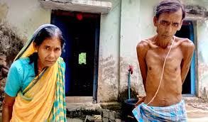 Viral Disease