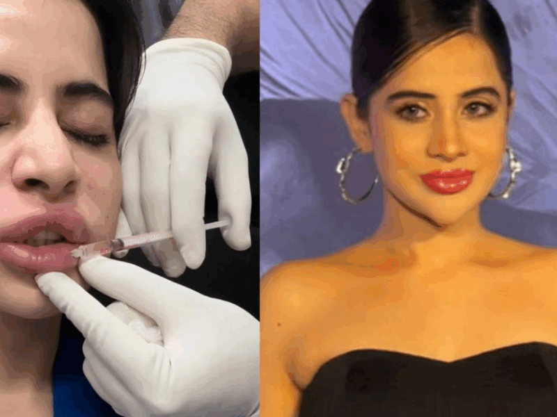 Urfi-Javed-Got-Trolled-For-Lip-Filler-Know-What-This-Treatment-Is-And-How-It-Can-Be-Removed