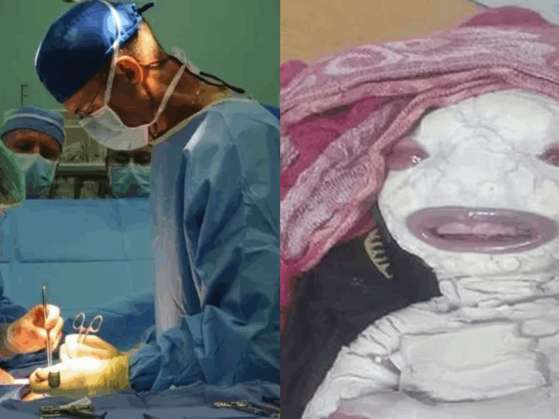 A Woman Gave Birth To A Child Who Looks Like An Alien, Even Doctors Were Shocked To See His Face