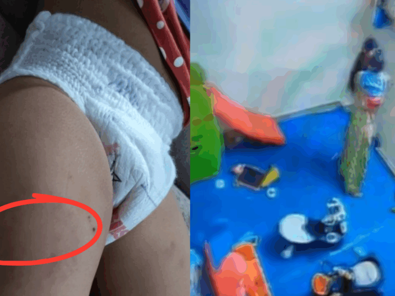 Brutality With A Child In A Daycare, A 15 Month Old Child Was Beaten And Bitten