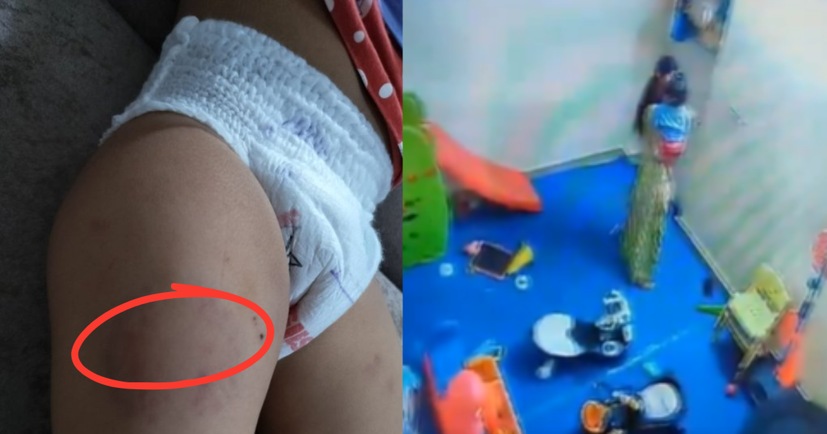 Brutality With A Child In A Daycare, A 15 Month Old Child Was Beaten And Bitten