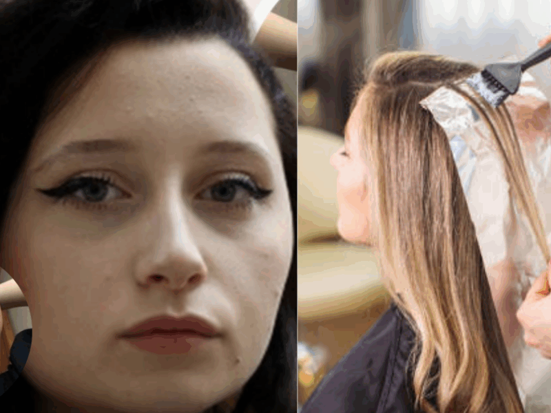 The-Girl-Bought-Hair-Dye-From-The-Supermarket-And-Was-Rushed-To-The-Hospital-The-Very-Next-Day-You-Will-Be-Shocked-To-Know-The-Reason